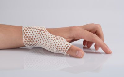 Creating Prosthetics with 3D Printing