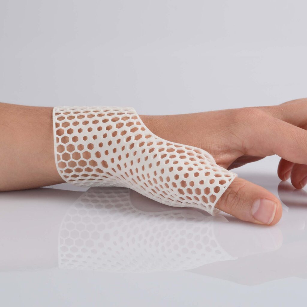 EOS_PA1101_orthosis_hand_with_hand_HighRes_cropped